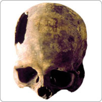 Cráneo del asesino conocido como 'Doctor Russi'